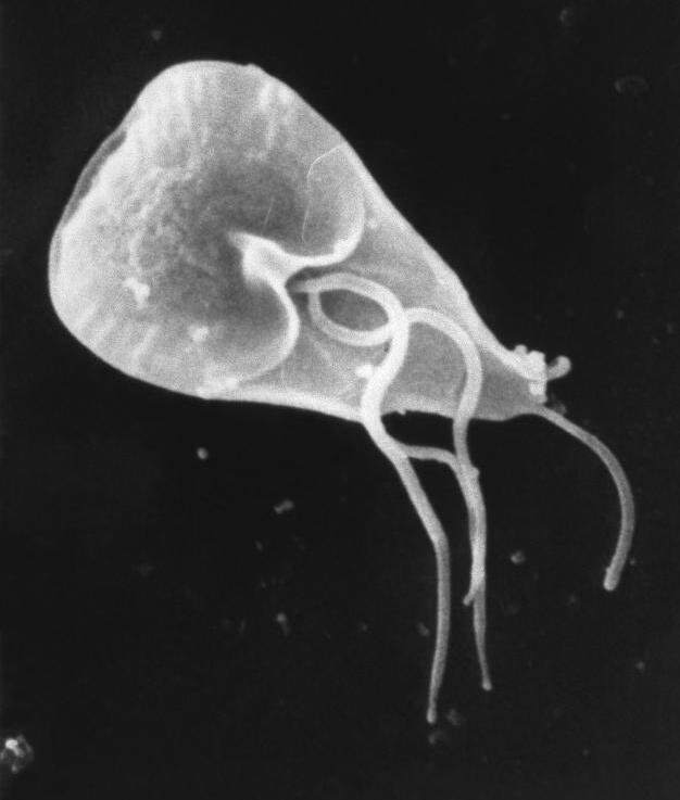 Scanning electron microscope image of a pear-shaped Giardia parasite with thread-like tails