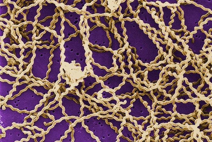 Scanning electron microscope image of thin, coiled Leptospira bacteria tangled together